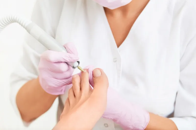 Darstellung zur speziellen Nagelbehandlung